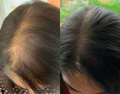 Crown & Bloom™ - Follicle Stimulating + DHT Blocking Botanical Hair Growth Serum