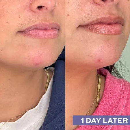 Daily SOS Rescue Hypochlorous Acid Facial Spray - Delune 