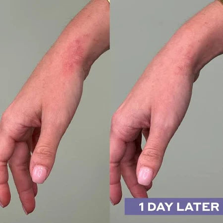 Daily SOS Rescue Hypochlorous Acid Facial Spray - Delune 