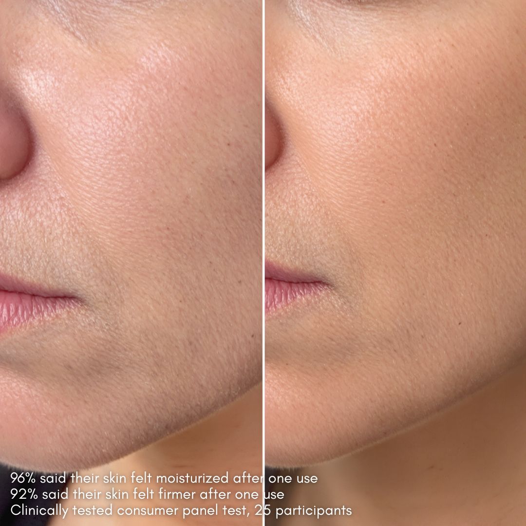 boost-rosehip-oil-serum-before-after-results - Delune 